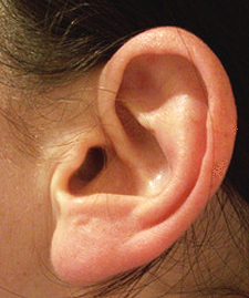 ear