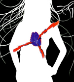 Woman heart attack