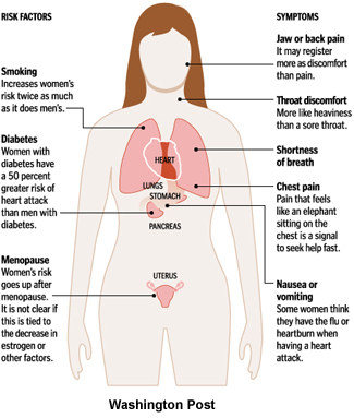 women heart attack symptoms. Woman Heart Attack